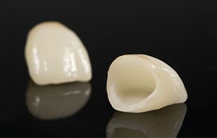 審美セラミック歯科治療