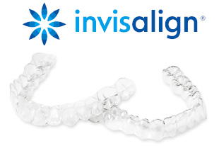 マウスピース矯正のインビザライン